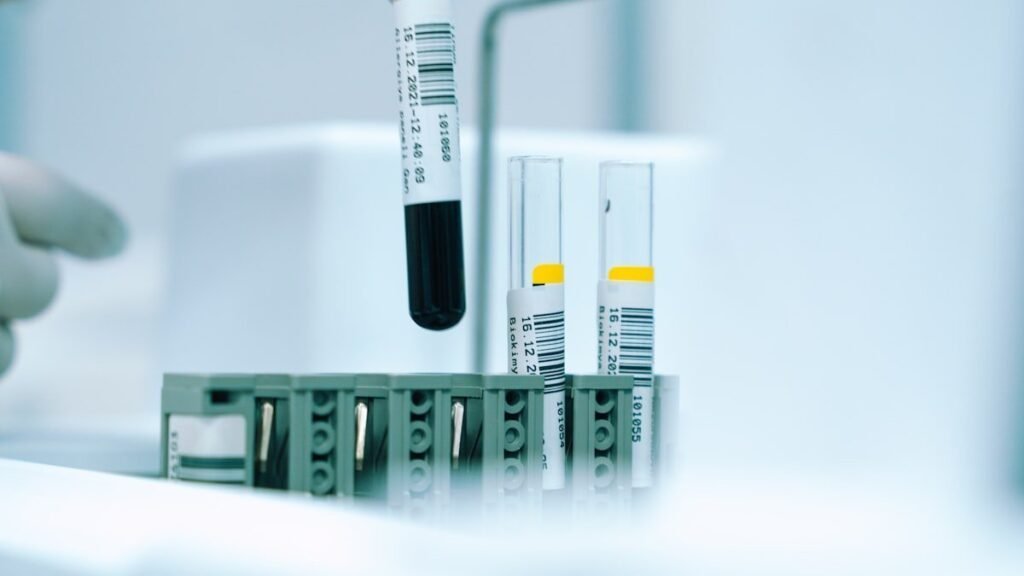 Lab technician handling specimen tubes for a Walmart drug test screening at a third-party clinic